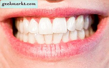 Paint.net'te Dişler Nasıl Beyazlatılır